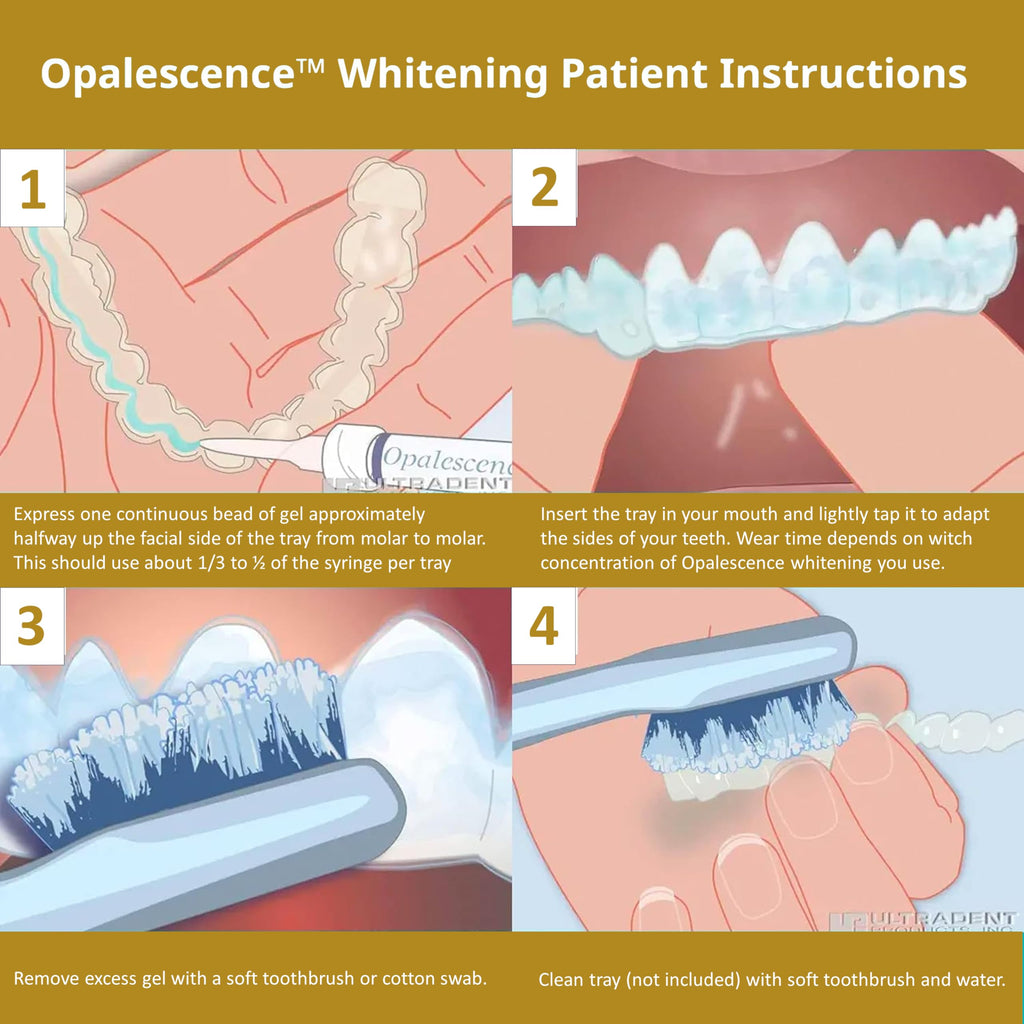 Opalescence 45% Whitening Gel – 4 Syringes Refill (Mint) | Ultradent PF