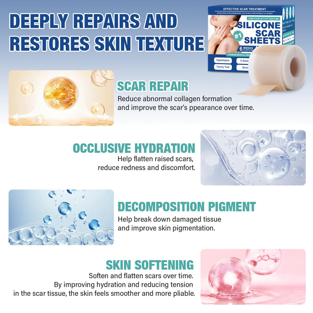 Mitreal Silicone Scar Sheets & Tape — 1.6x158 Roll for Surgical Scars & Keloids