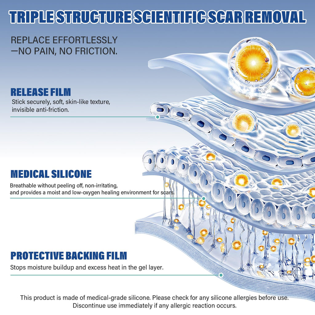 Mitreal Silicone Scar Sheets & Tape — 1.6x158 Roll for Surgical Scars & Keloids
