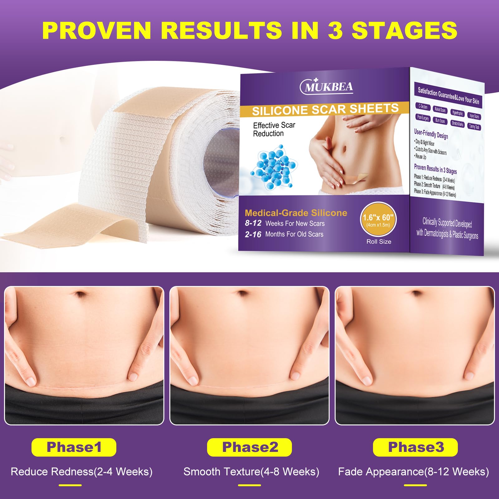 MUKBEA Silicone Scar Sheets & Tape – Reusable Scar Tape for Keloids, Surgical Scars, C-Section, Acne Scars (1.6” x 60” Roll, 1.5m)