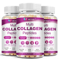 Multi Collagen Peptides Softgels – Type I, II, III, V, X for Skin, Hair, Nails & Joints | Non-GMO