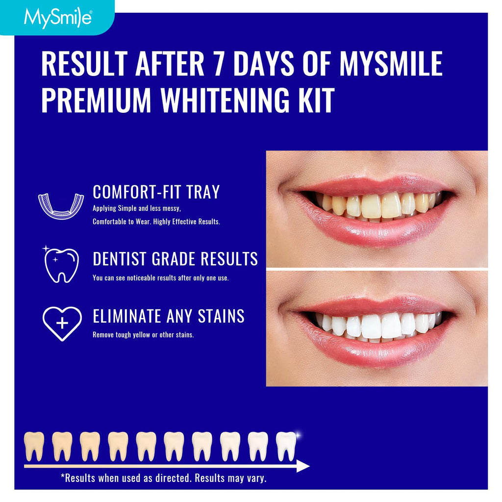 MySmile 7-Day Prefilled Teeth Whitening Trays Kit – 12% Hydrogen Peroxide, Mint