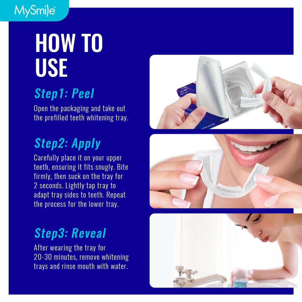 MySmile 7-Day Prefilled Teeth Whitening Trays Kit – 12% Hydrogen Peroxide, Mint