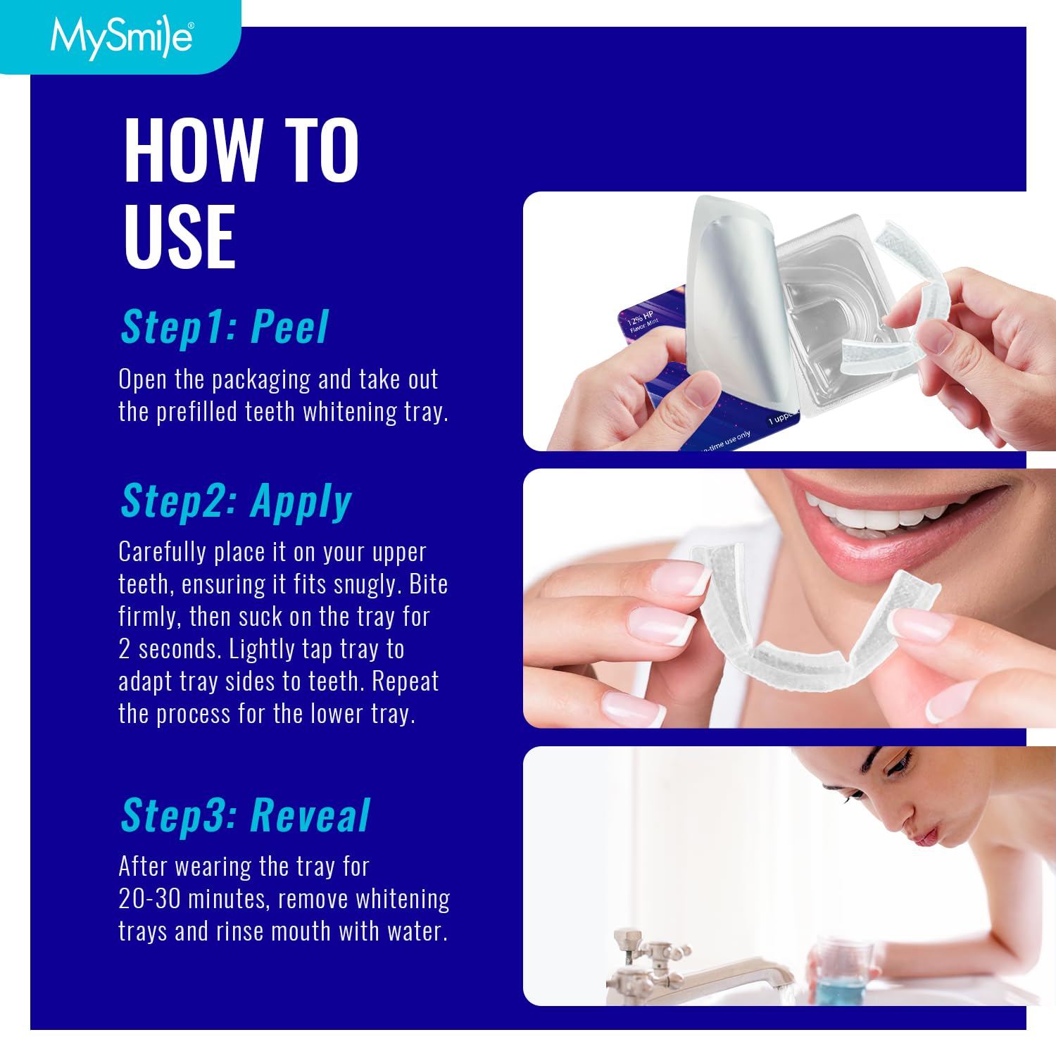 MySmile 7-Day Prefilled Teeth Whitening Trays Kit – 12% Hydrogen Peroxide, Mint