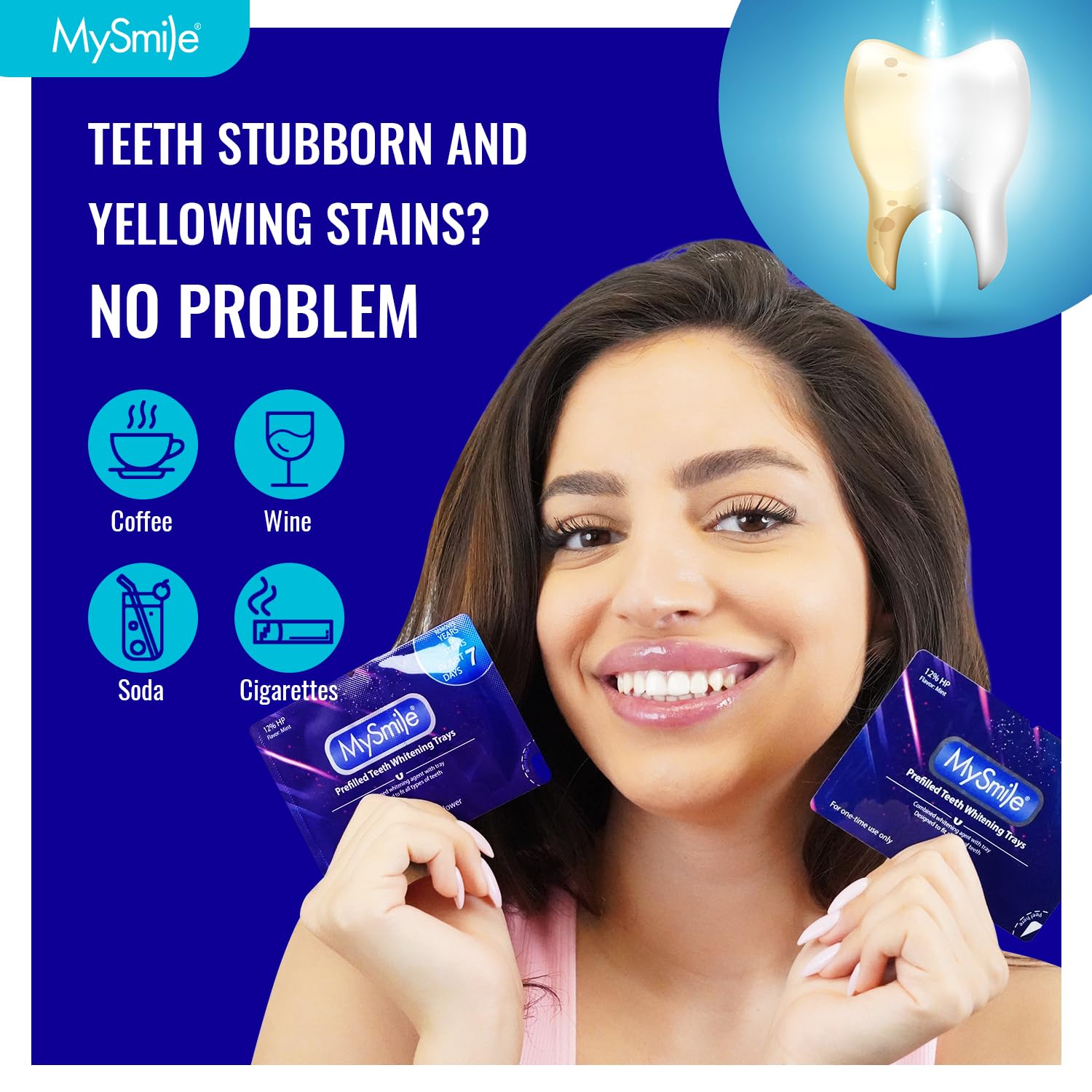 MySmile 7-Day Prefilled Teeth Whitening Trays Kit – 12% Hydrogen Peroxide, Mint