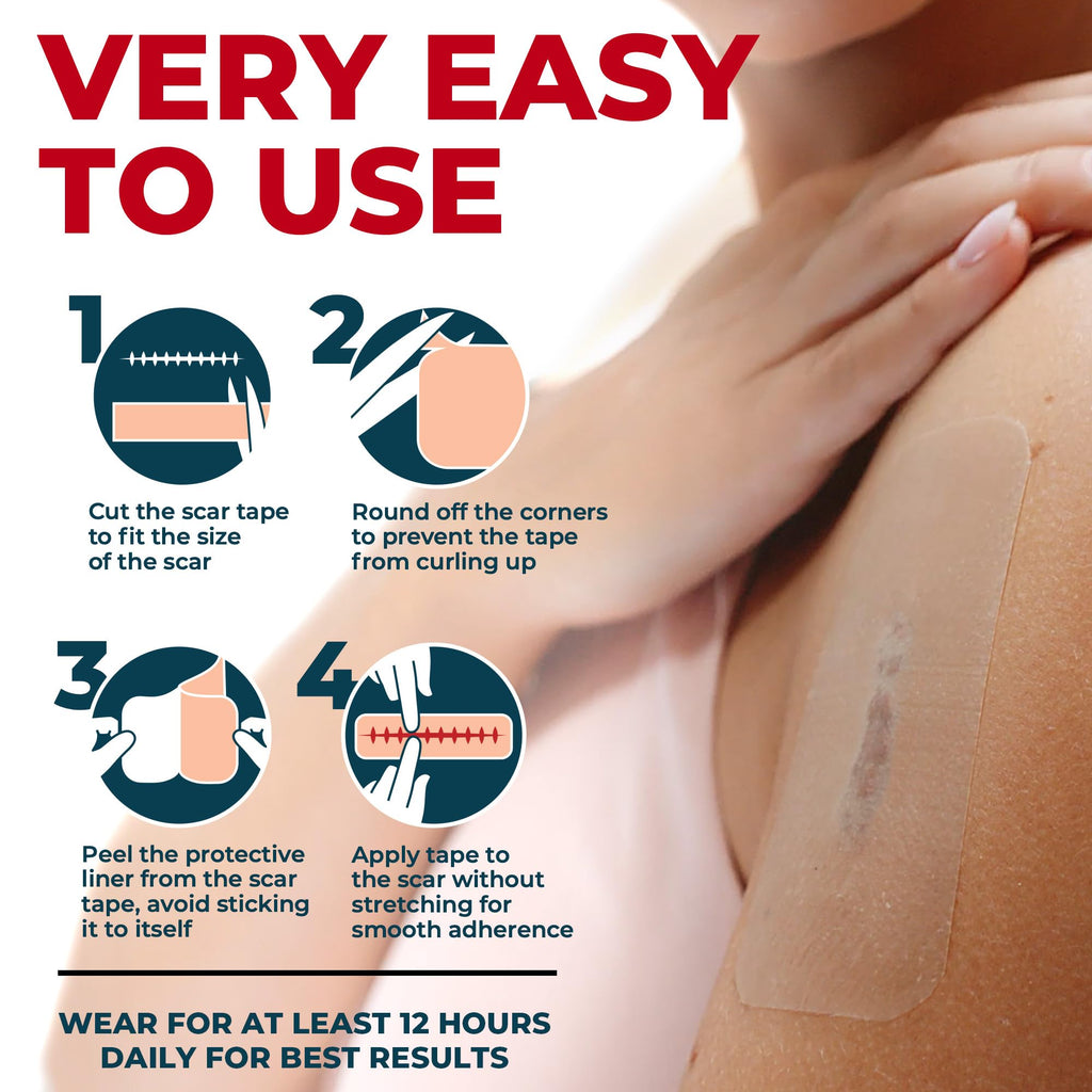 MYHELP Medical Grade Silicone Scar Tape - Transparent 1.6in x 120in for Surgical & Keloid Scars