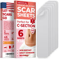 MYHELP Medical Grade Silicone Scar Sheets – Transparent 6pk (7in x 1.6in) for C-Section Scars