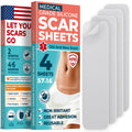MYHELP Medical Grade Silicone Scar Sheets - Transparent 4pk (5.7 x 1.6) for Surgical, Keloid & C-Section Scars