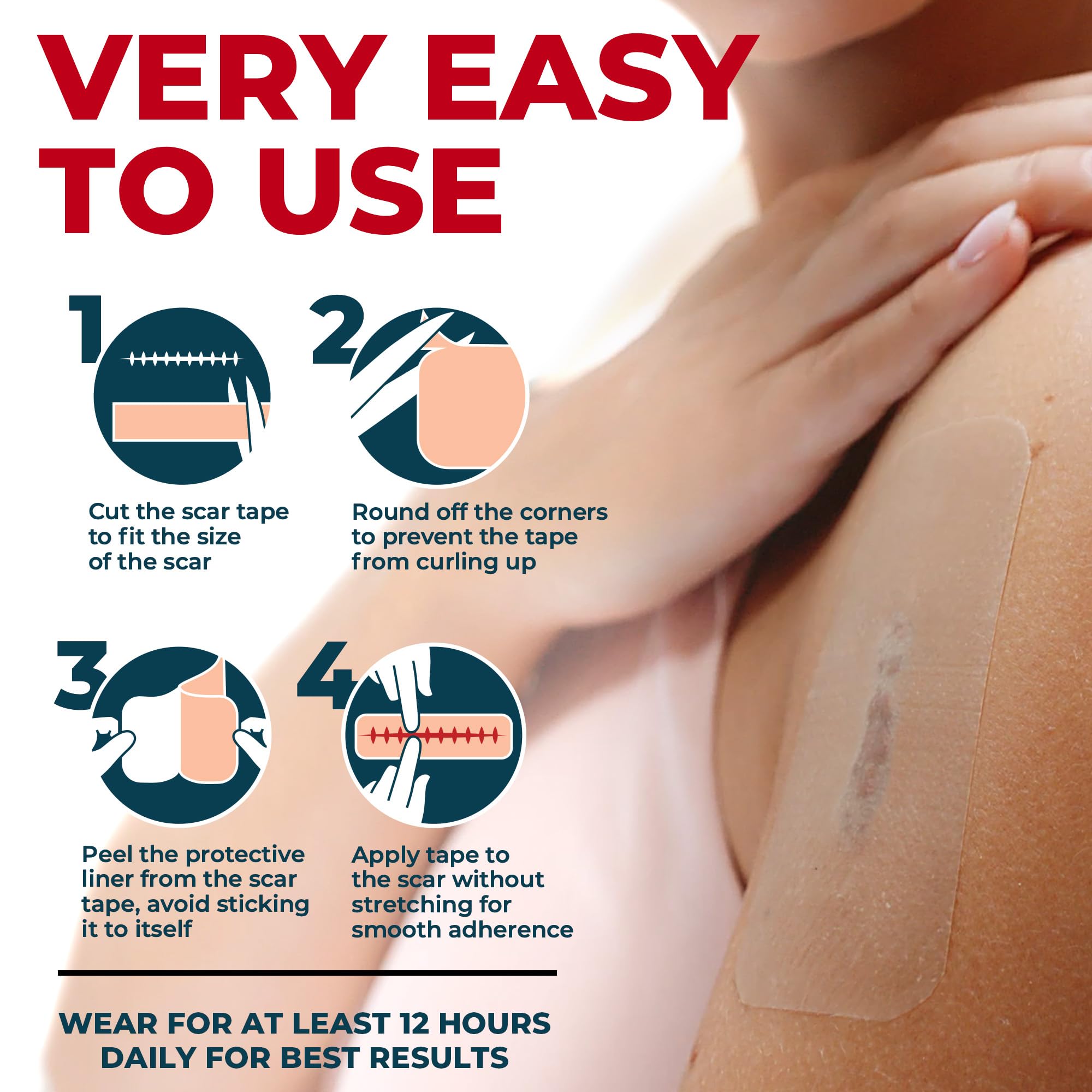 MYHELP Medical Grade Silicone Scar Tape - Transparent 1.6”x150”