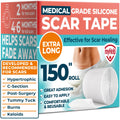 MYHELP Medical Grade Silicone Scar Tape - Transparent 1.6”x150”
