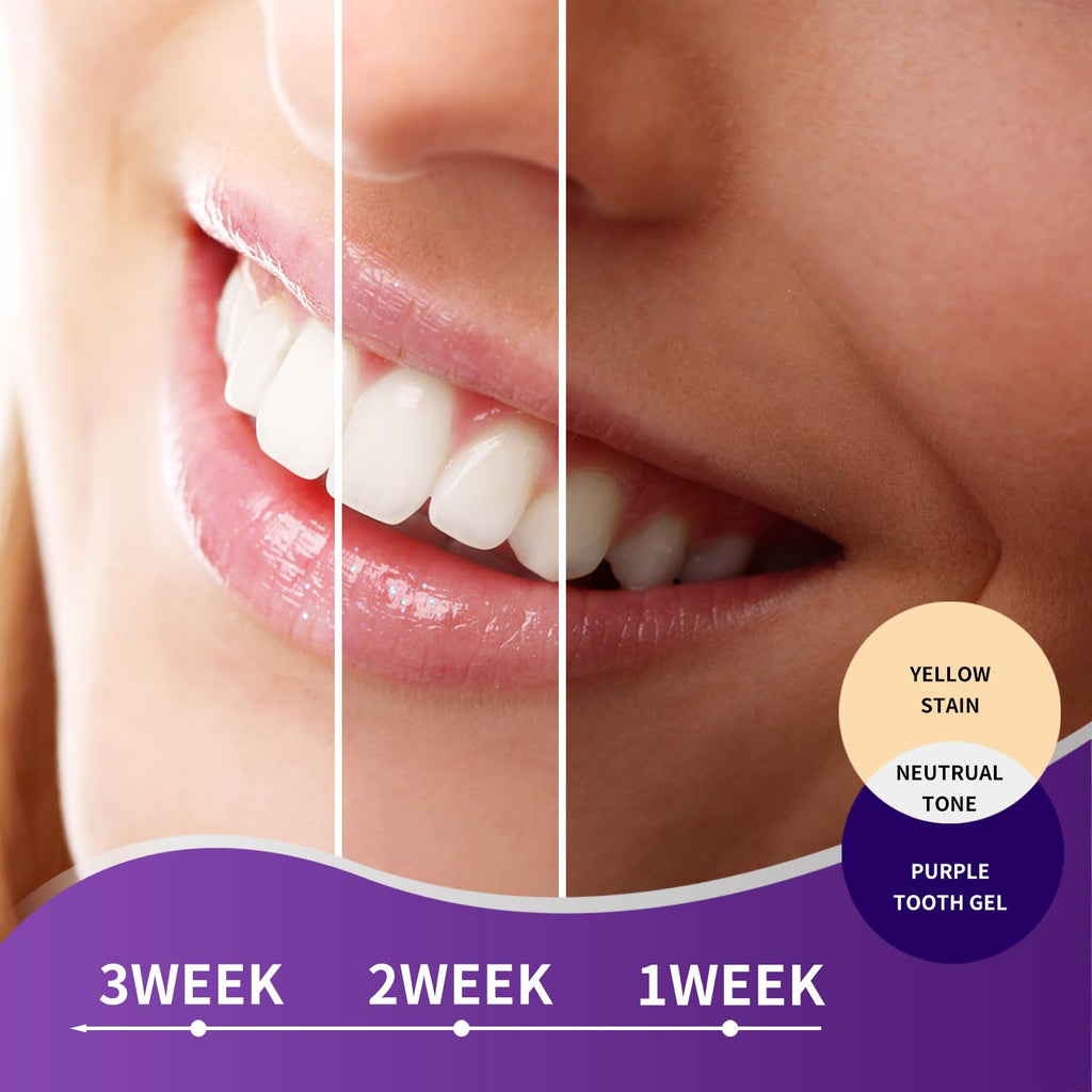 MySmile Purple Toothpaste - Color Correction & Brightening (30ML) | Non-Sensitive, Fresh Mint