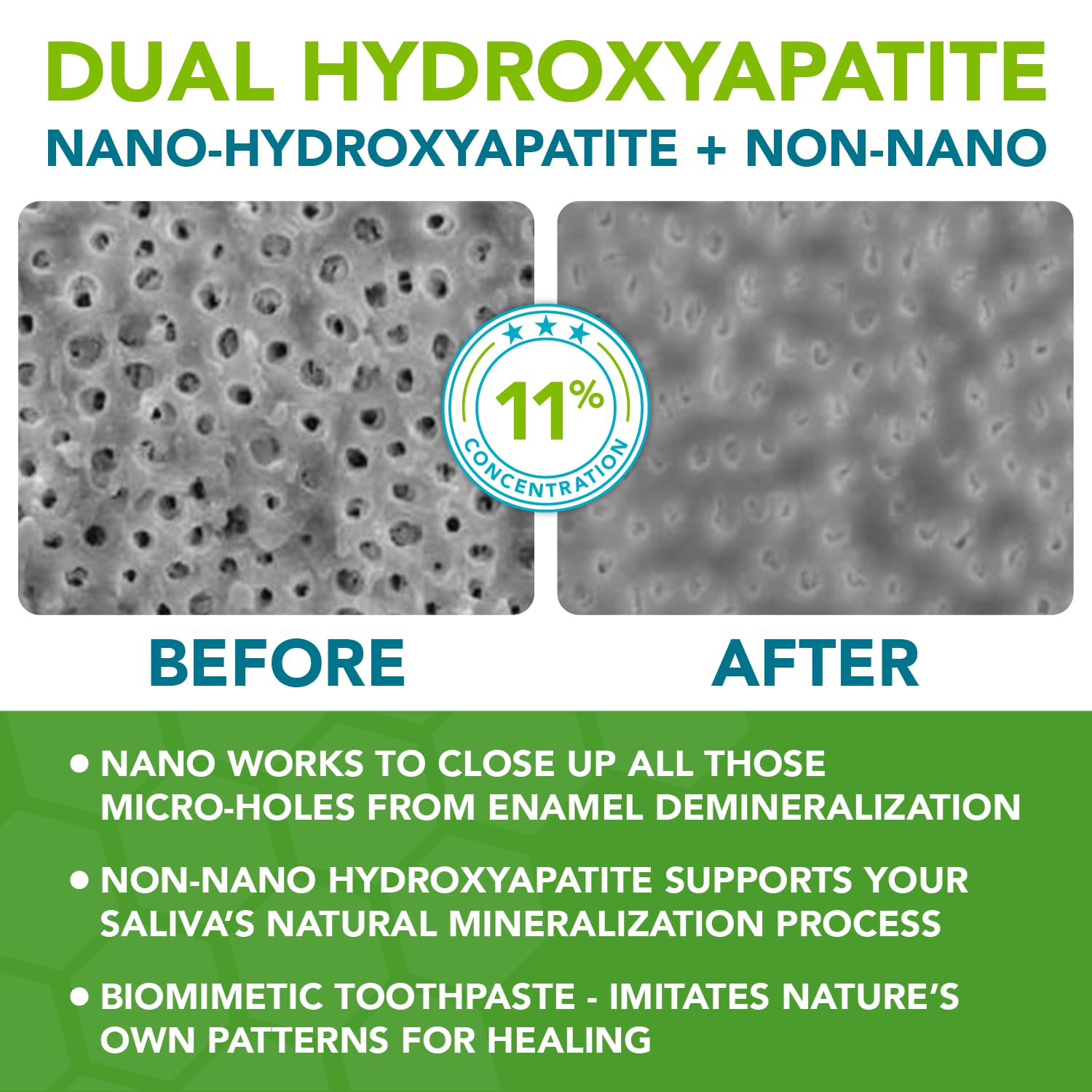 Nano Hydroxyapatite Toothpaste Fluoride Free – Dentist Formulated Pro Remineralizing Toothpaste Citrus Blast