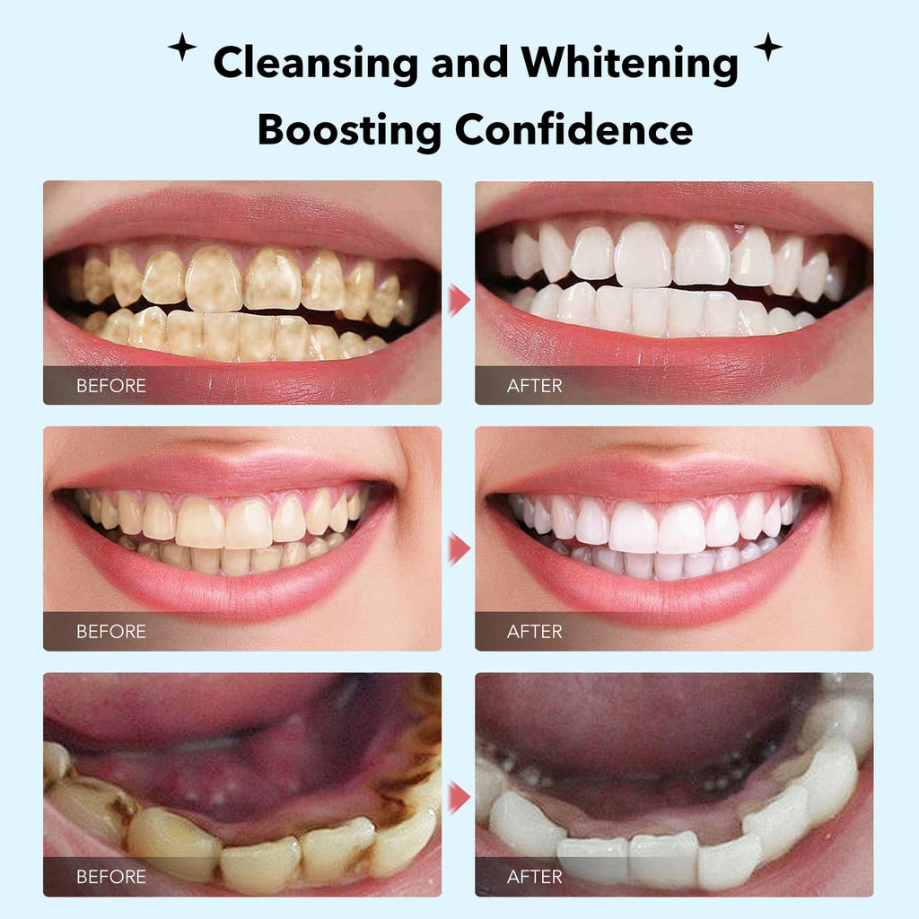 Fluoride-Free Nano Hydroxyapatite Toothpaste – Whitening & Remineralizing (4.23oz)