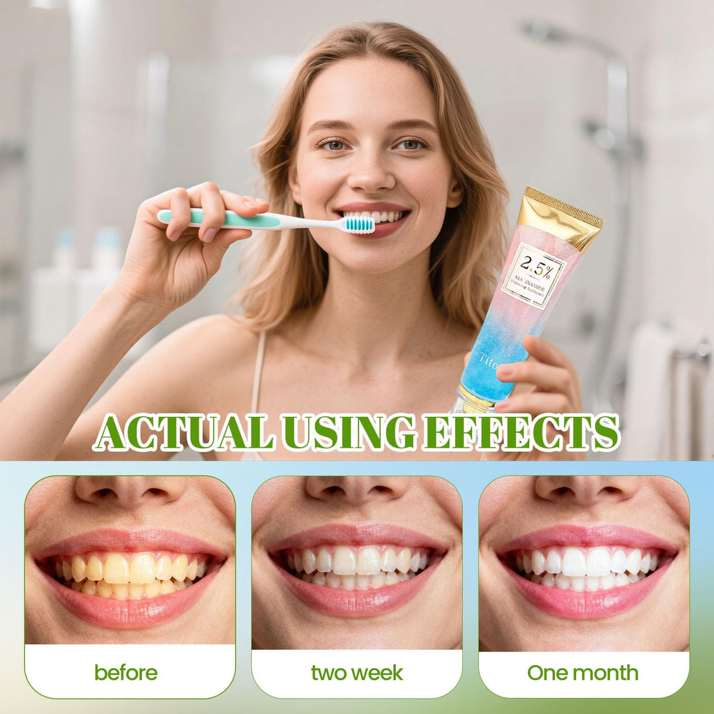 Niacinamide Whitening Toothpaste 2.5% – Gentle Stain Removal & Gum Health | Titoty