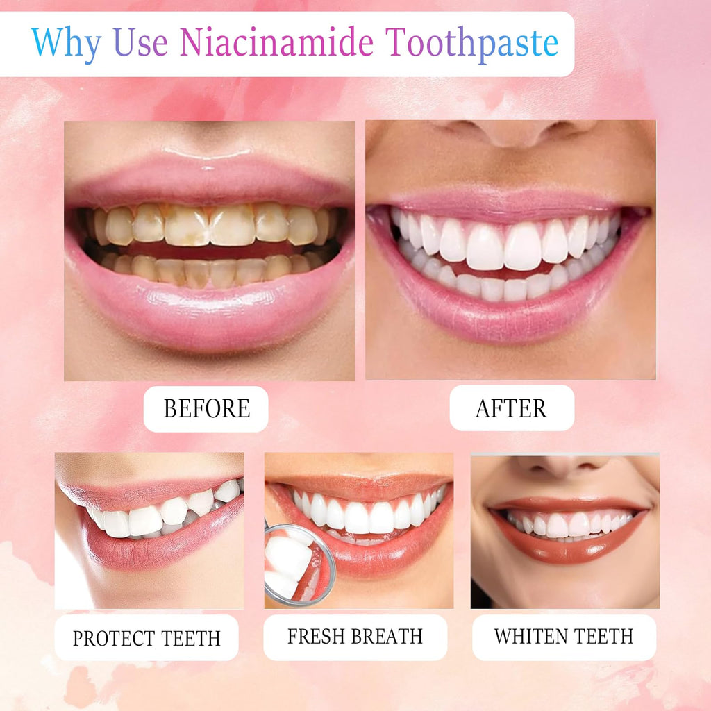 Niacinamide Whitening Toothpaste | Probiotic, Fluoride-Free, Sensitivity Relief