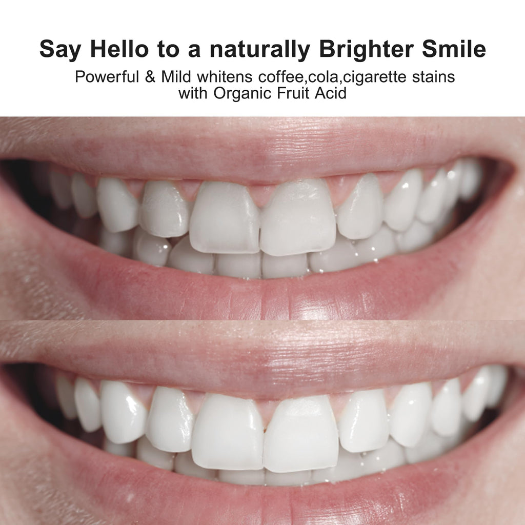 Nobaton 1% Fruit Acid Whitening Ampoule Toothpaste with Nano HAP – Enamel-Safe Brightening (3 Bottles, 1.23 oz Each)
