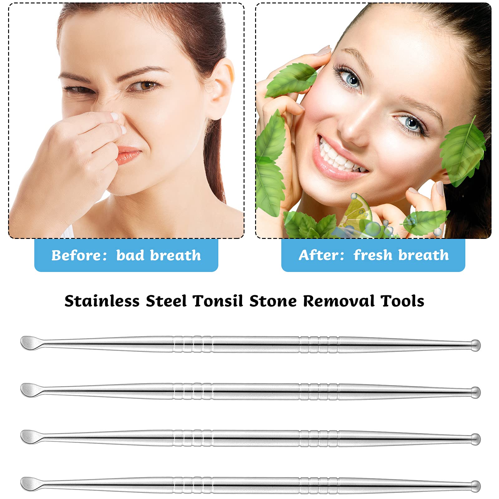 Nuanchu 4-Piece Stainless Steel Tonsil Stone Removal Tools - Bad Breath Solution