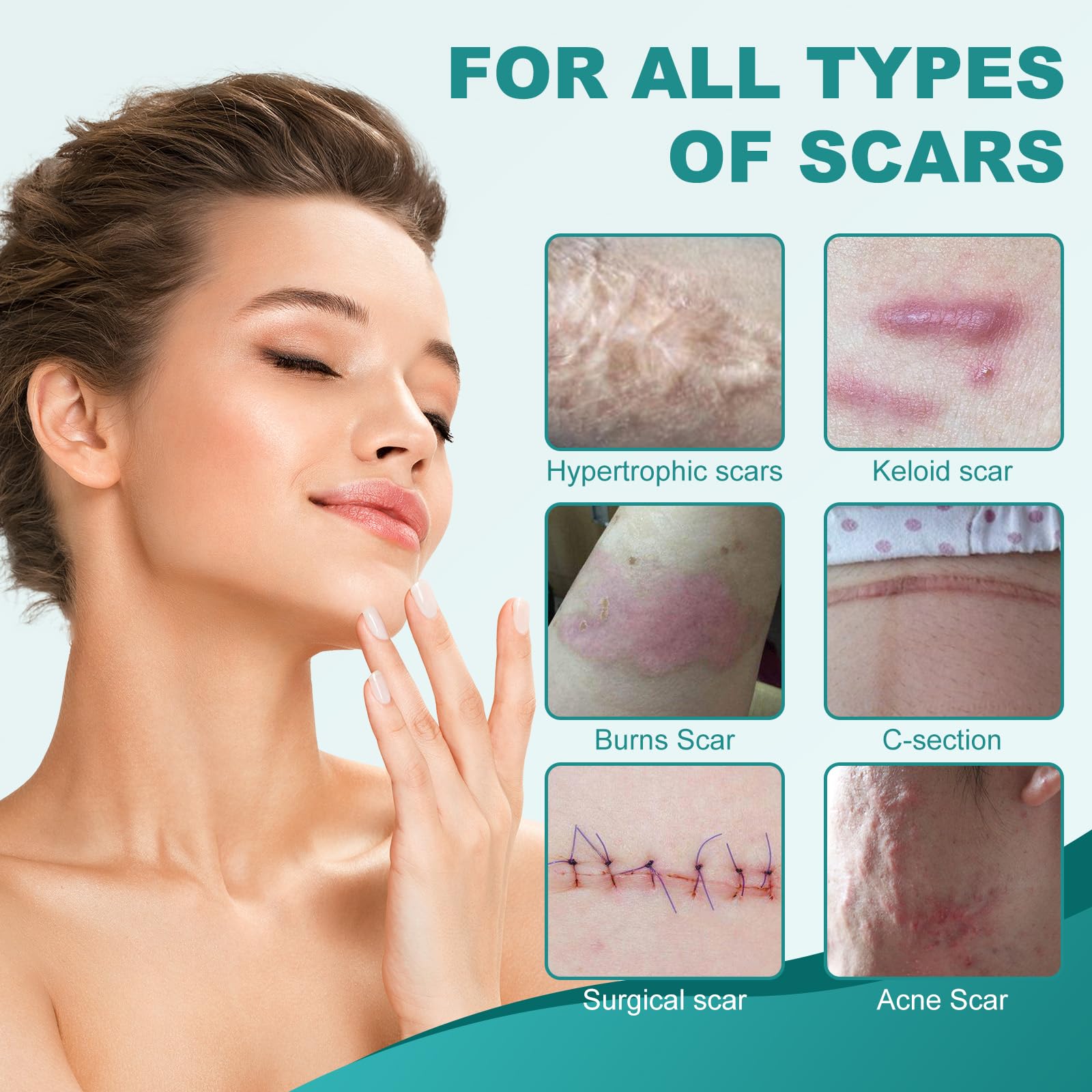 Nullam Silicone Scar Sheets & Tape – Reusable, Breathable Scar Care (1.6 x 158 in)