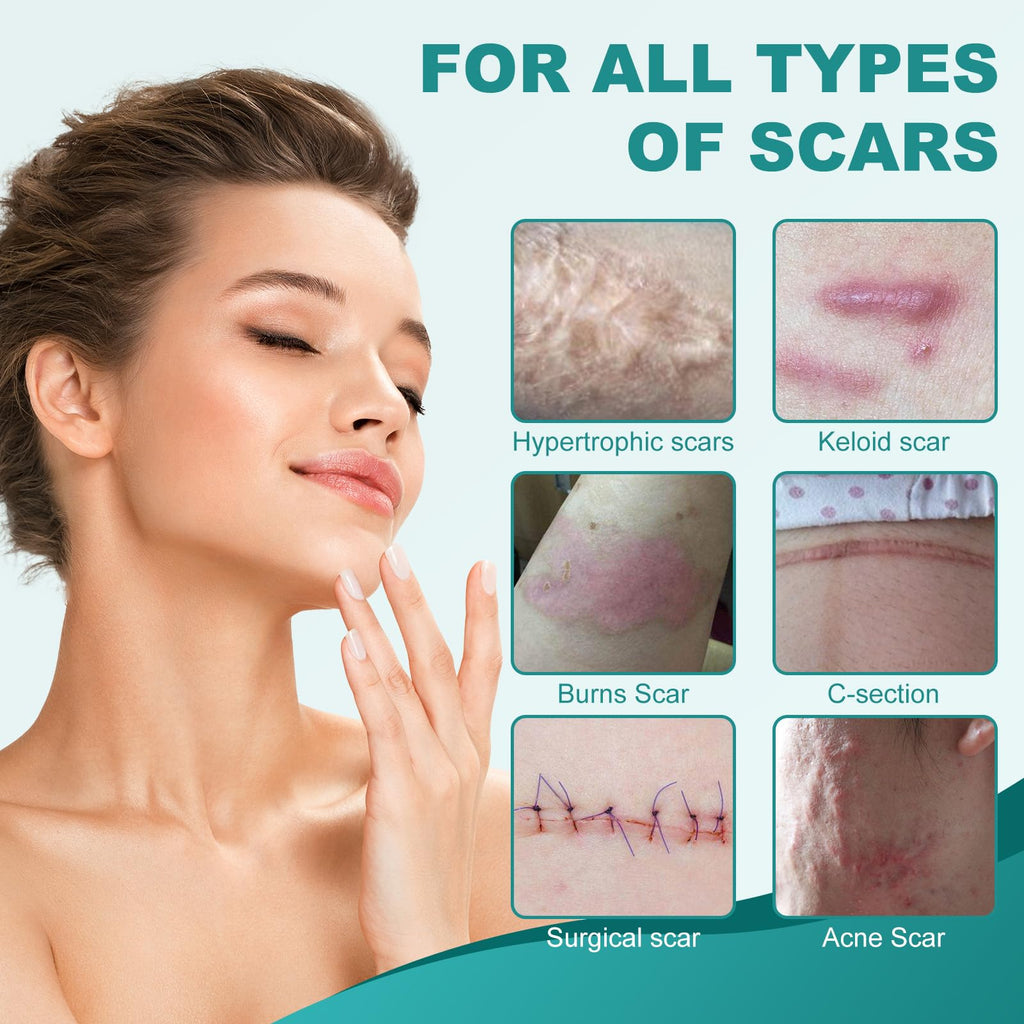 Nullam Silicone Scar Sheets & Tape Roll (1.6 x 59 in) for Surgical, C-Section & Keloid Scars