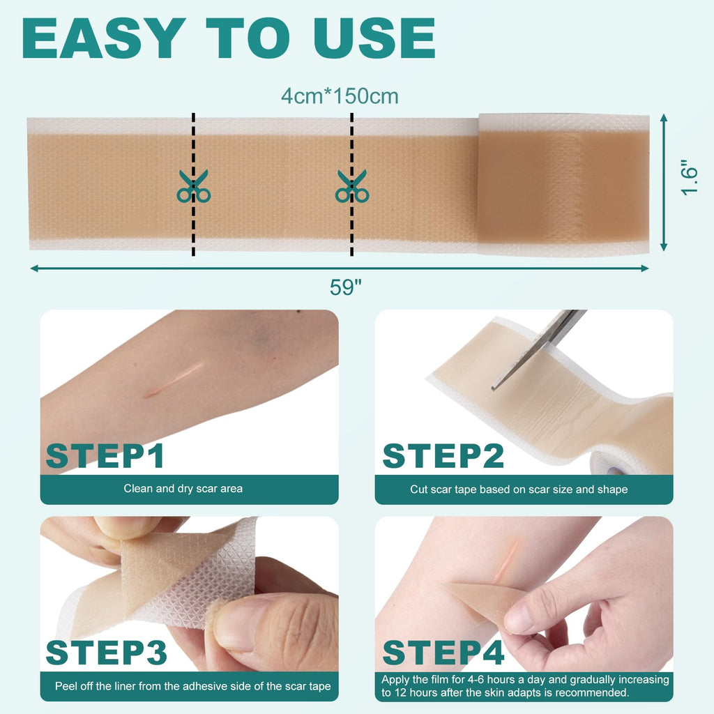 Nullam Silicone Scar Sheets & Tape Roll (1.6 x 59 in) for Surgical, C-Section & Keloid Scars