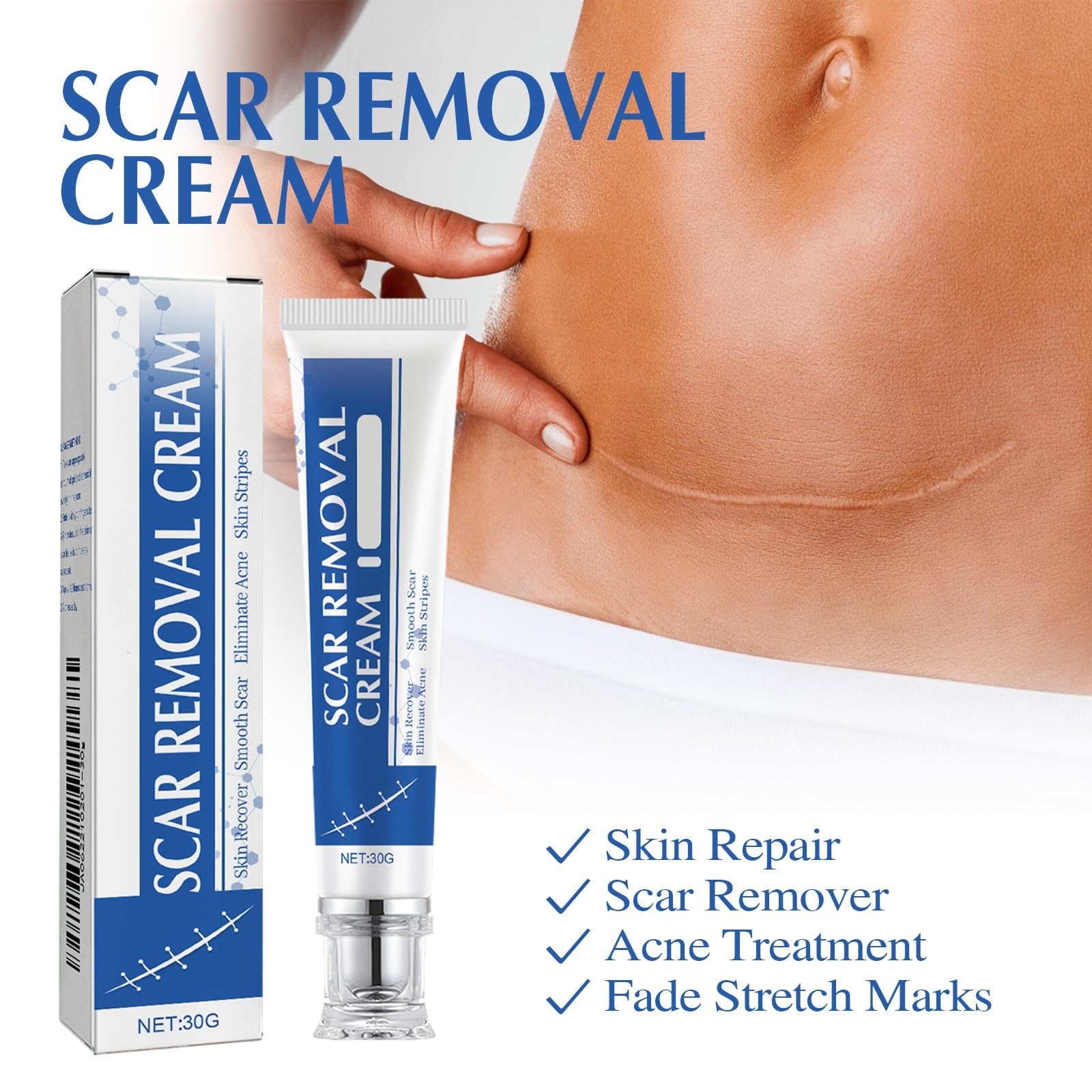 NYYQYYN Scar Cream • Silicone Gel for Surgical Scars & Keloids | All-Natural, Quick-Drying