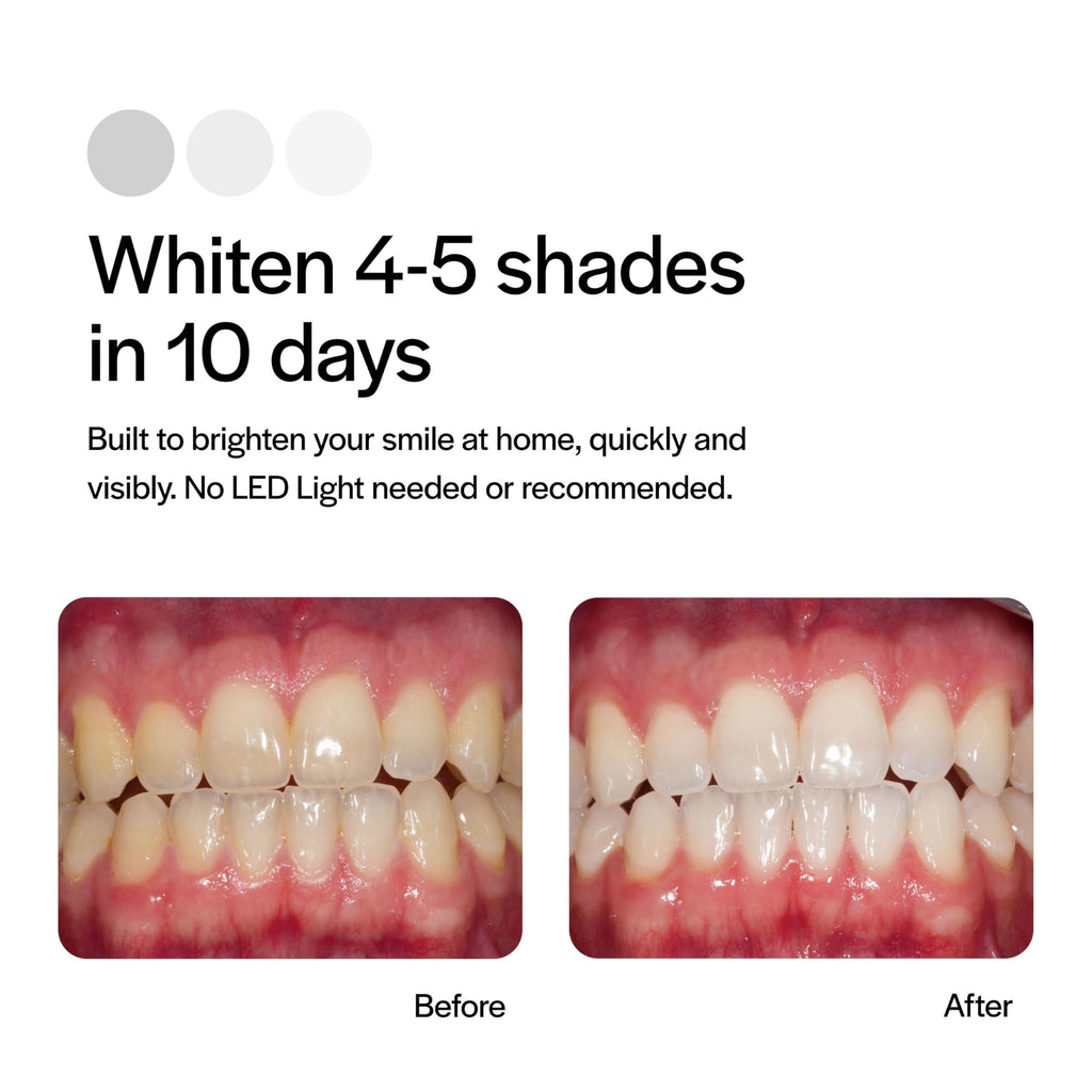 Opalescence Go 15% Mint Teeth Whitening Trays – 10 Treatments | Ultradent