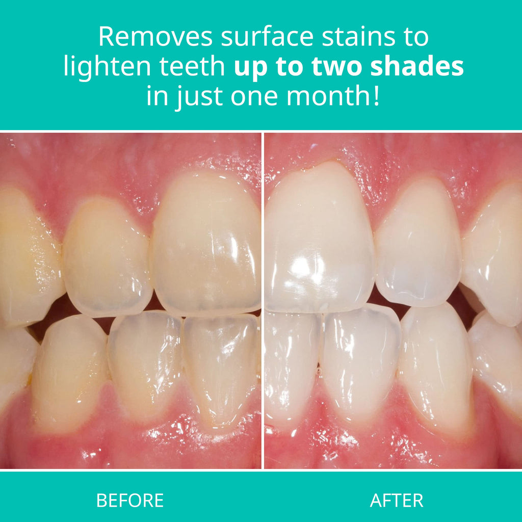 Opalescence Whitening Toothpaste for Sensitive Teeth (2 Pack) - Mint, Gluten Free | TP-5167-2
