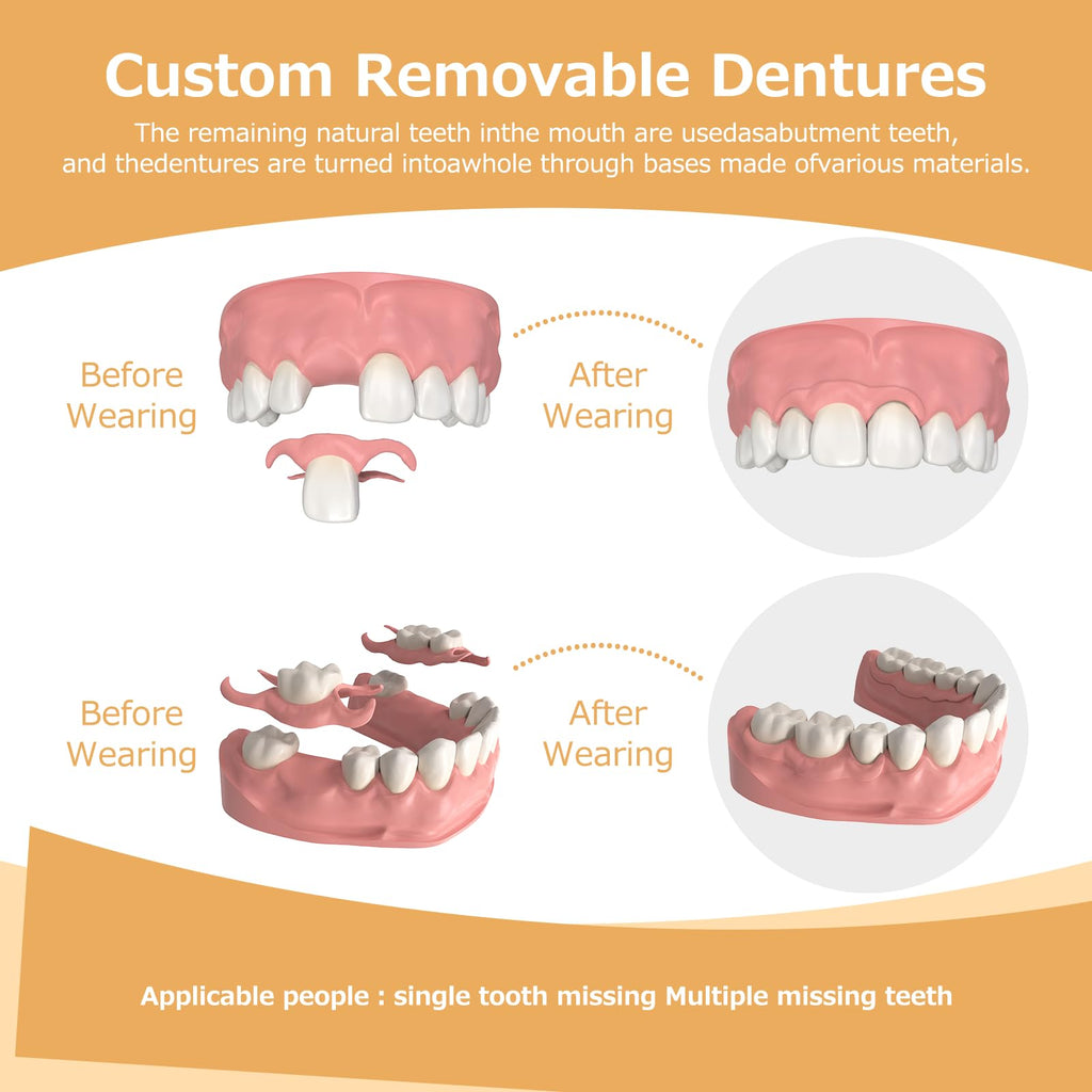 Partial Dentures - Lightweight, Unbreakable Replacement Teeth (5 Teeth) for Missing Teeth | Men & Women