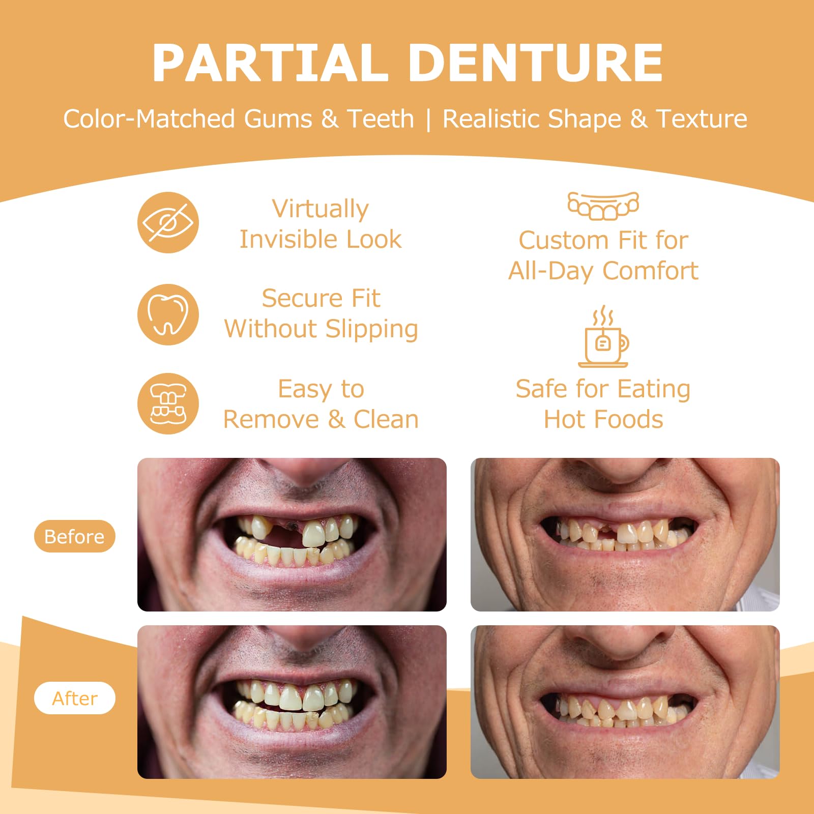Partial Dentures for Missing Teeth & Gaps — Lightweight, Unbreakable Replacement Teeth (1 Tooth)