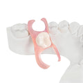Partial Dentures - Custom Removable Tooth Replacement for Missing Teeth (1 Tooth)