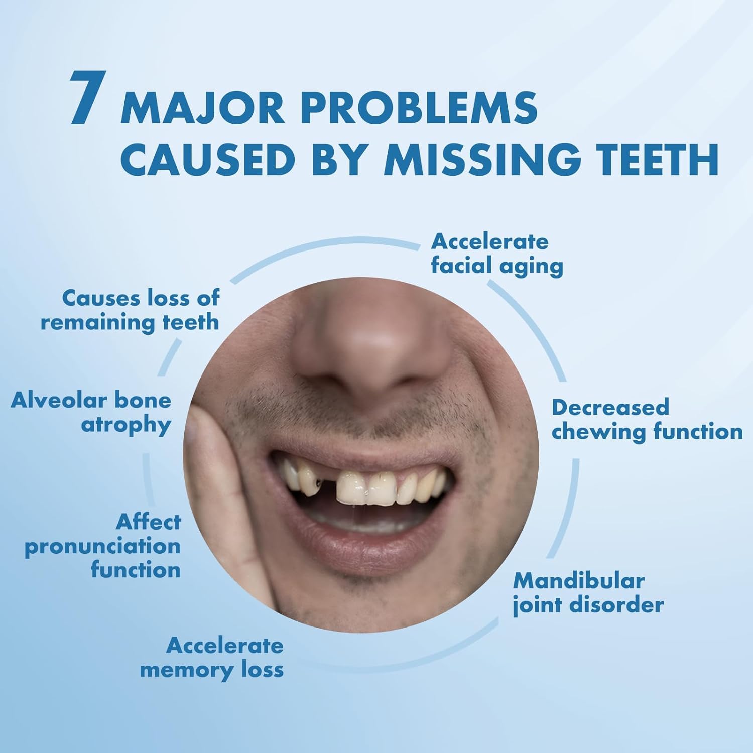 Partial Dentures - Custom Removable Tooth Replacement for Missing Teeth (1 Tooth)