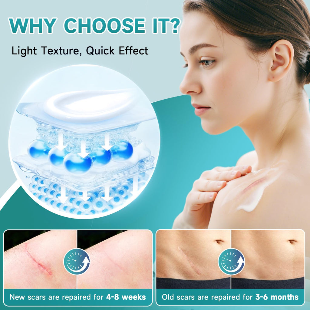 Pumkot Advanced Scar Cream — Silicone Gel for Surgical Scars & Stretch Marks (1.7 oz)