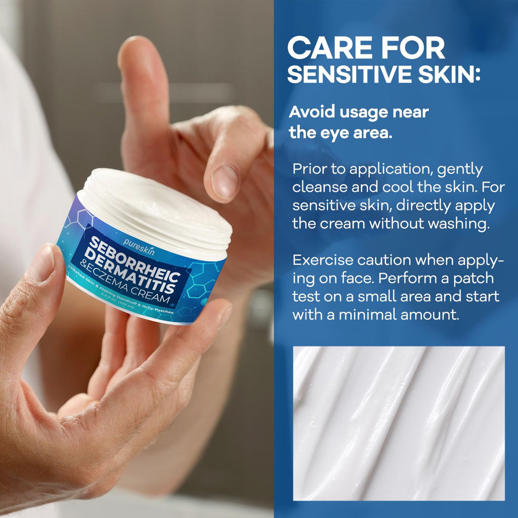 PureSkin Seborrheic Dermatitis & Psoriasis Cream – Steroid-Free Herbal Antifungal (3.4 oz)