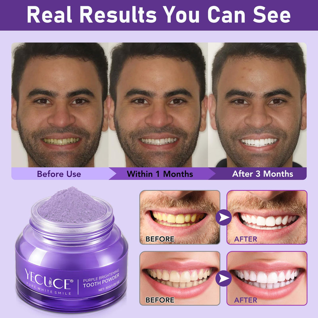 Purple Teeth Whitening Powder 30g - Removes Stains & Mint Fresh Breath