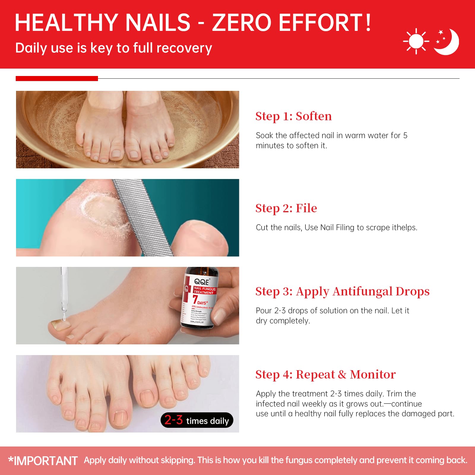 QQE Nail Fungus Treatment Extra Strength - 25% Undecylenic Acid