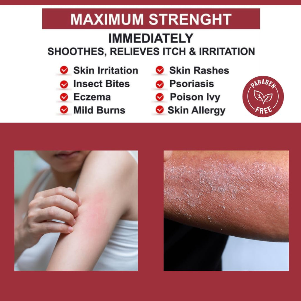 QUATRIDERM NF Extra Strength Hydrocortisone 1% Cream with Aloe Vera – Paraben-Free, 2 oz
