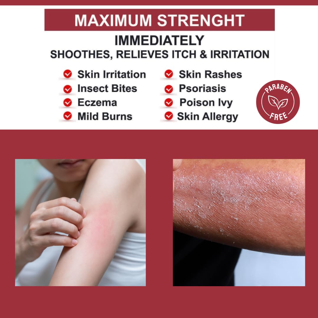 QUATRIDERM NF Extra Strength Hydrocortisone 1% Cream with Aloe Vera – Paraben-Free, 2 oz