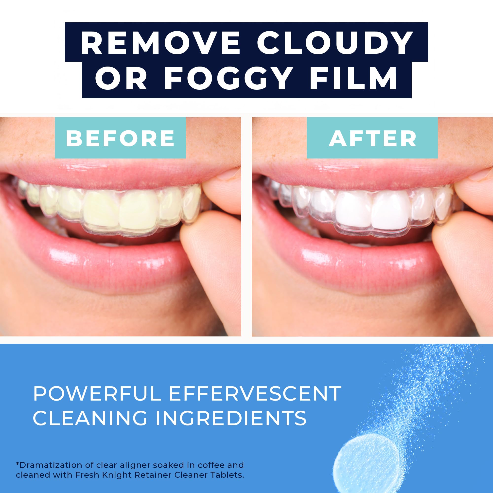 Retainer Cleaner Tablets 120 | Invisalign, Denture & Dental Appliance Cleaner - 4 Month Supply