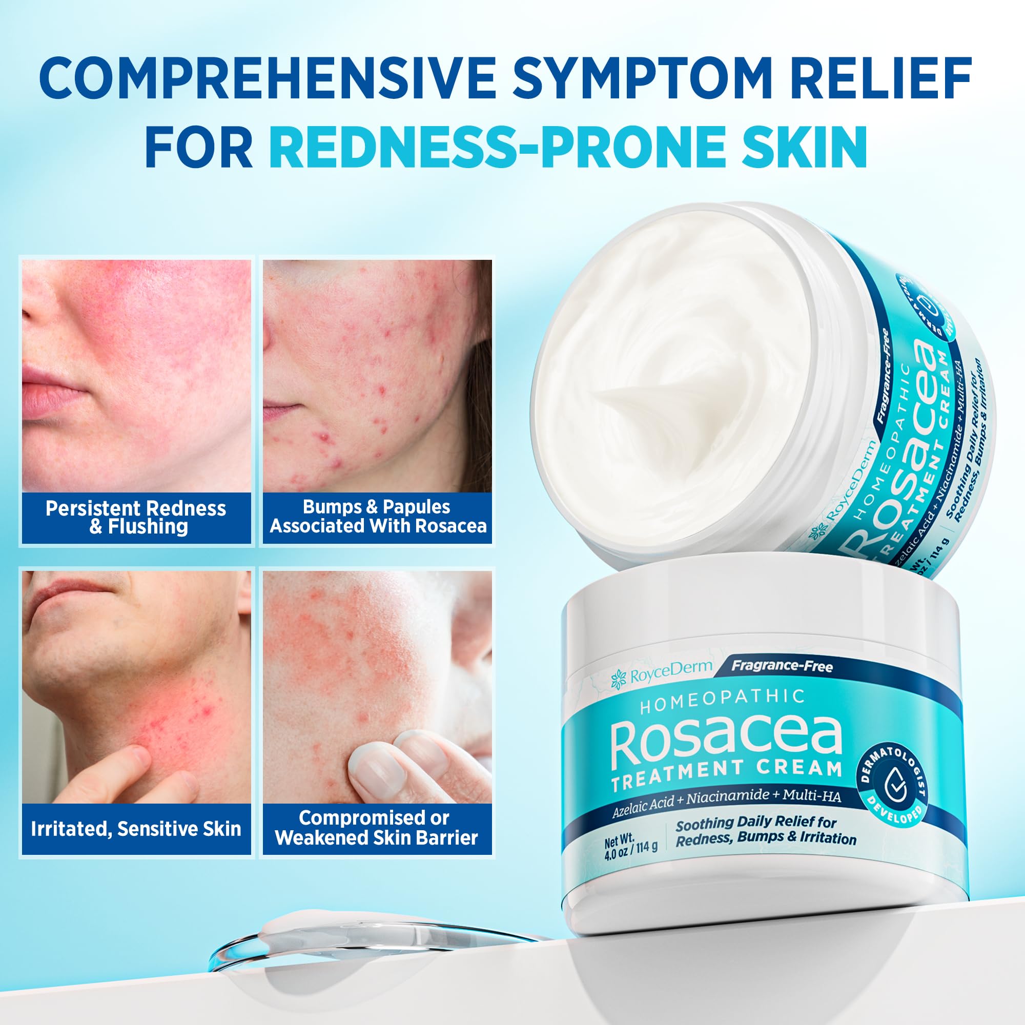 Roycederm Rosacea Treatment with Azelaic Acid – Redness Relief & Corrector for Sensitive Skin