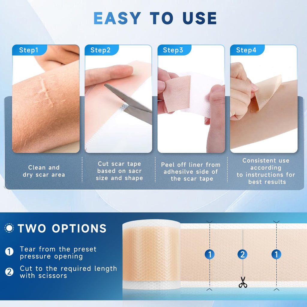 Rvlaim Silicone Scar Sheets Tape Roll 1.6” x 60” – Breathable, Reusable Scar Care for Surgical Scars, Keloids, Stretch Marks