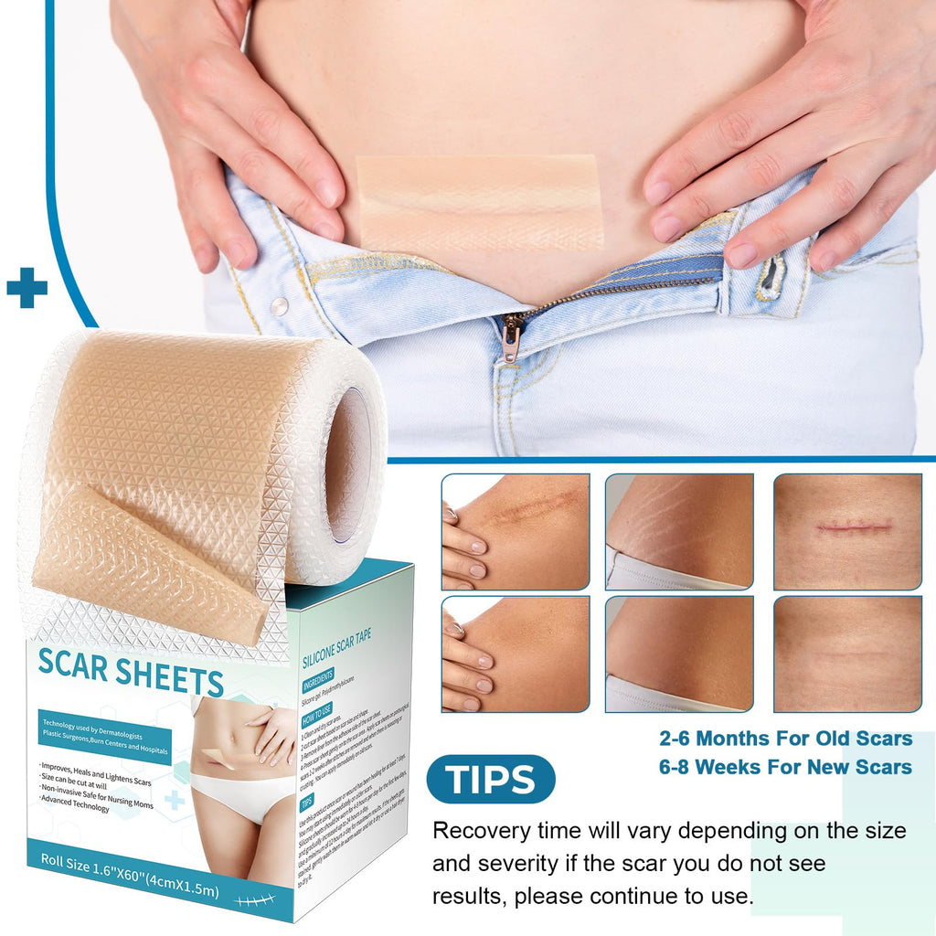 Rvlaim Silicone Scar Sheets & Tape (1.6”x60” Roll) – Gentle, Flexible Scar Care