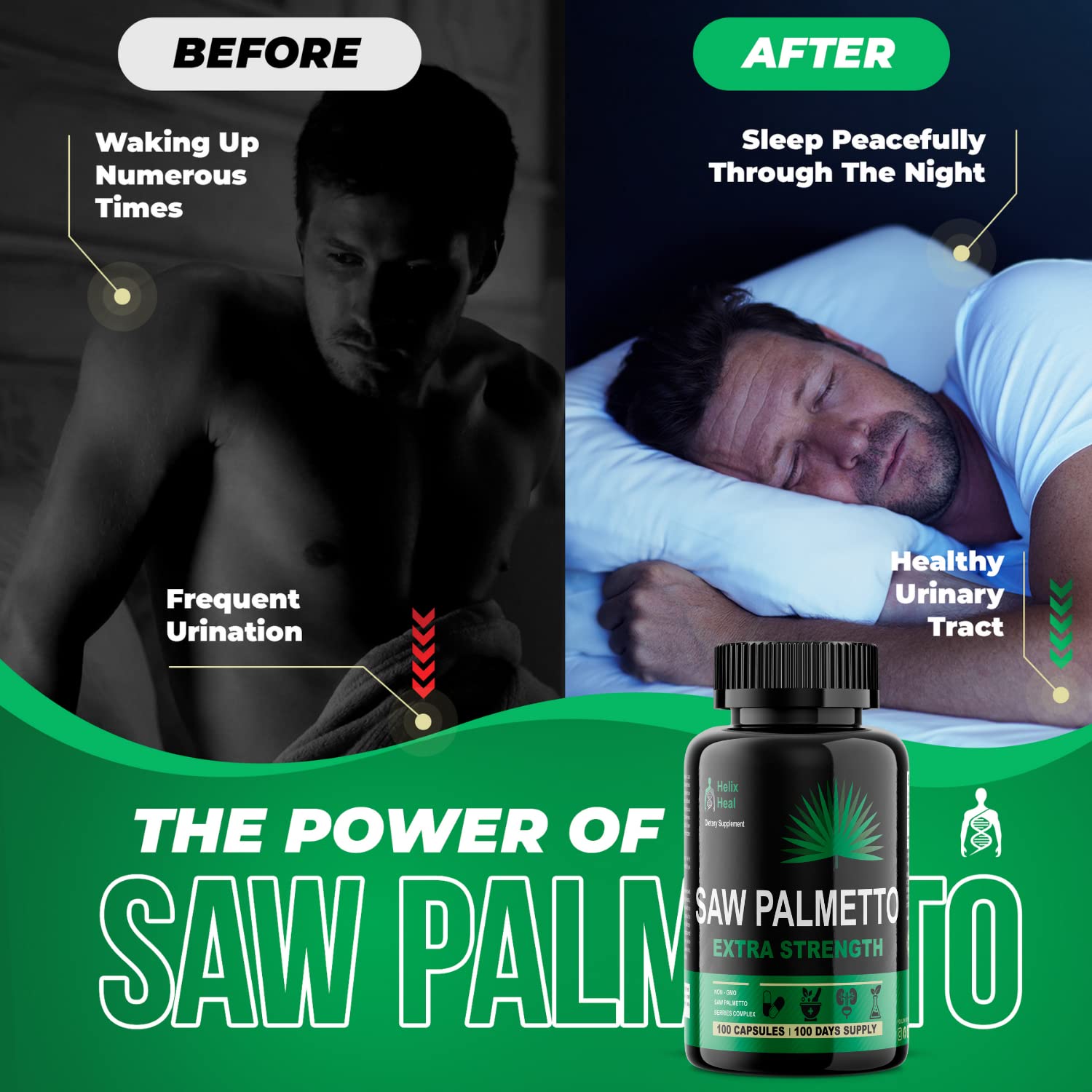 Saw Palmetto for Men - 500mg Prostate Health & Hair Growth (100 capsules)