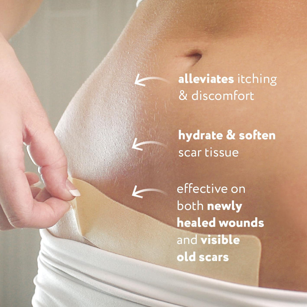 ScarAway Advanced Silicone Scar Sheets for C-Section & Surgeries – 4 Sheets (1.5” x 7”)
