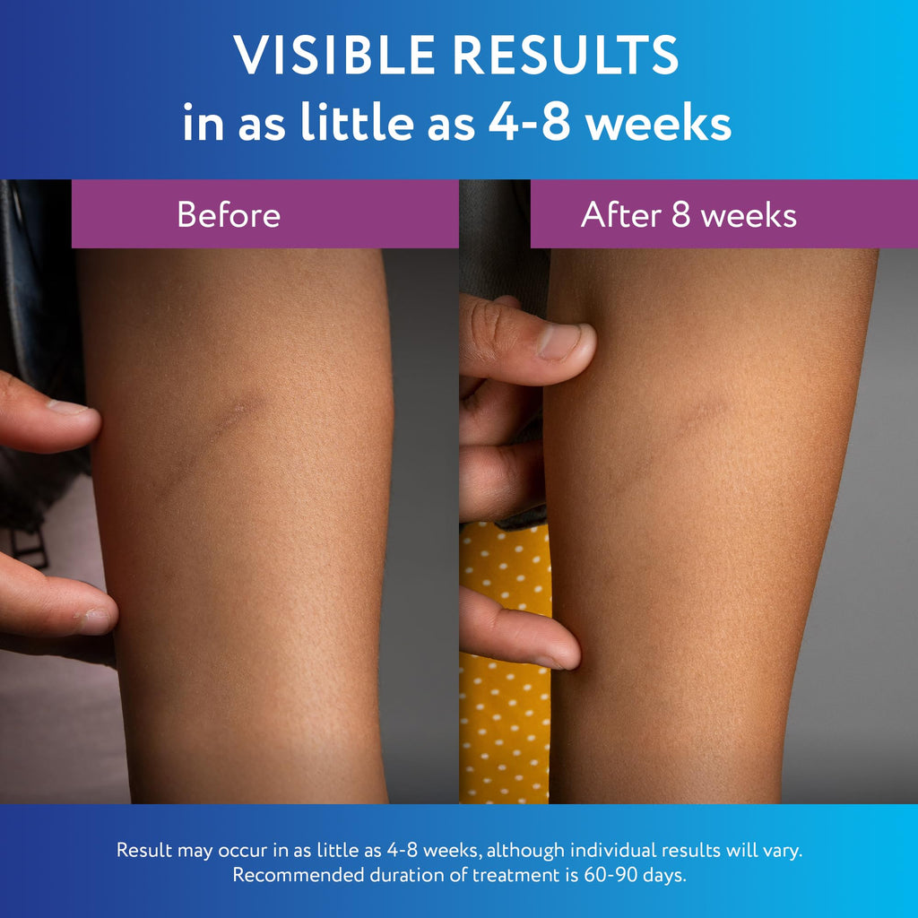 ScarAway Silicone Scar Gel - Improve Scar Size, Color & Texture | Water-Resistant 20g