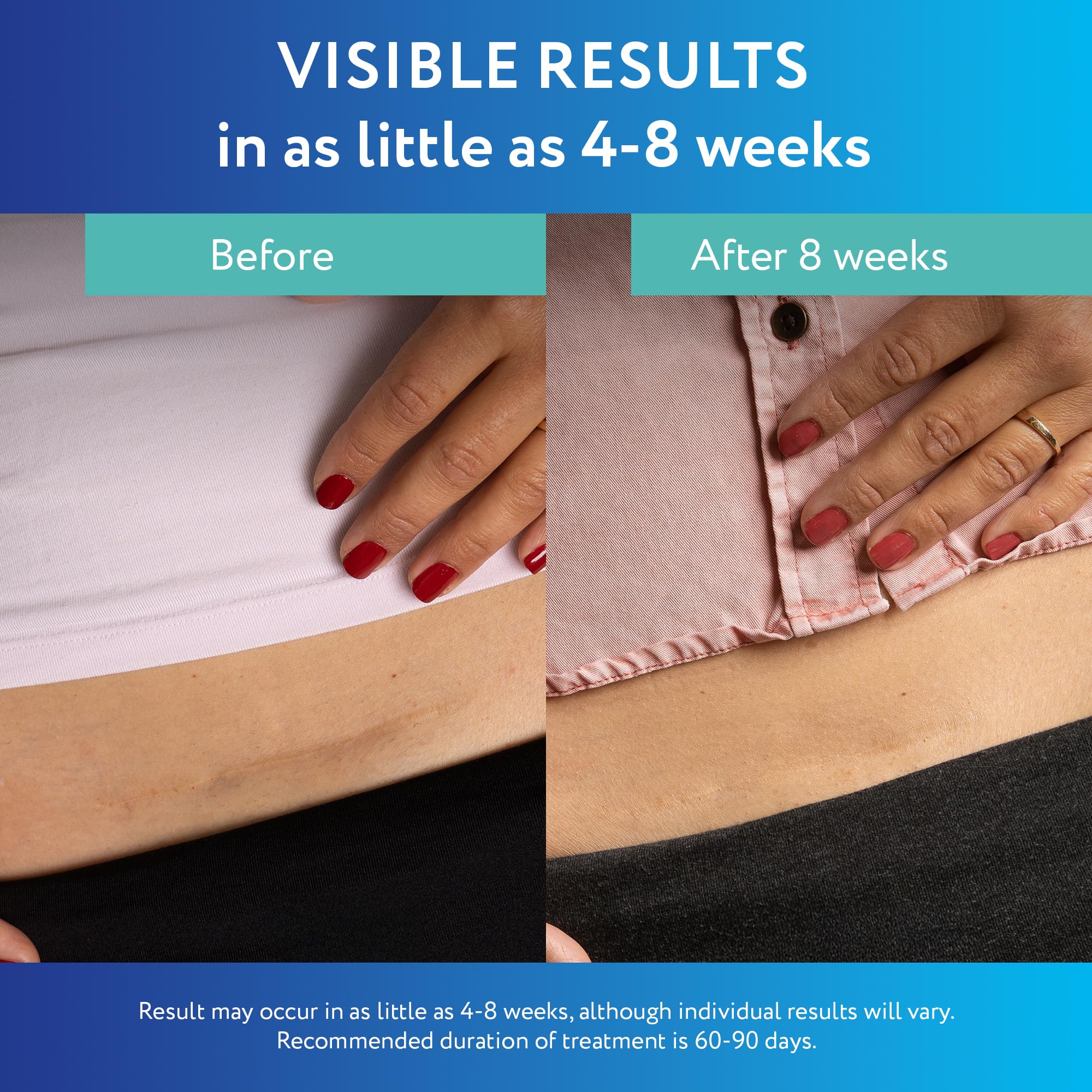 ScarAway Advanced Clear Silicone Scar Sheets (1.5 x 3 in) – 6 Medical-Grade Sheets