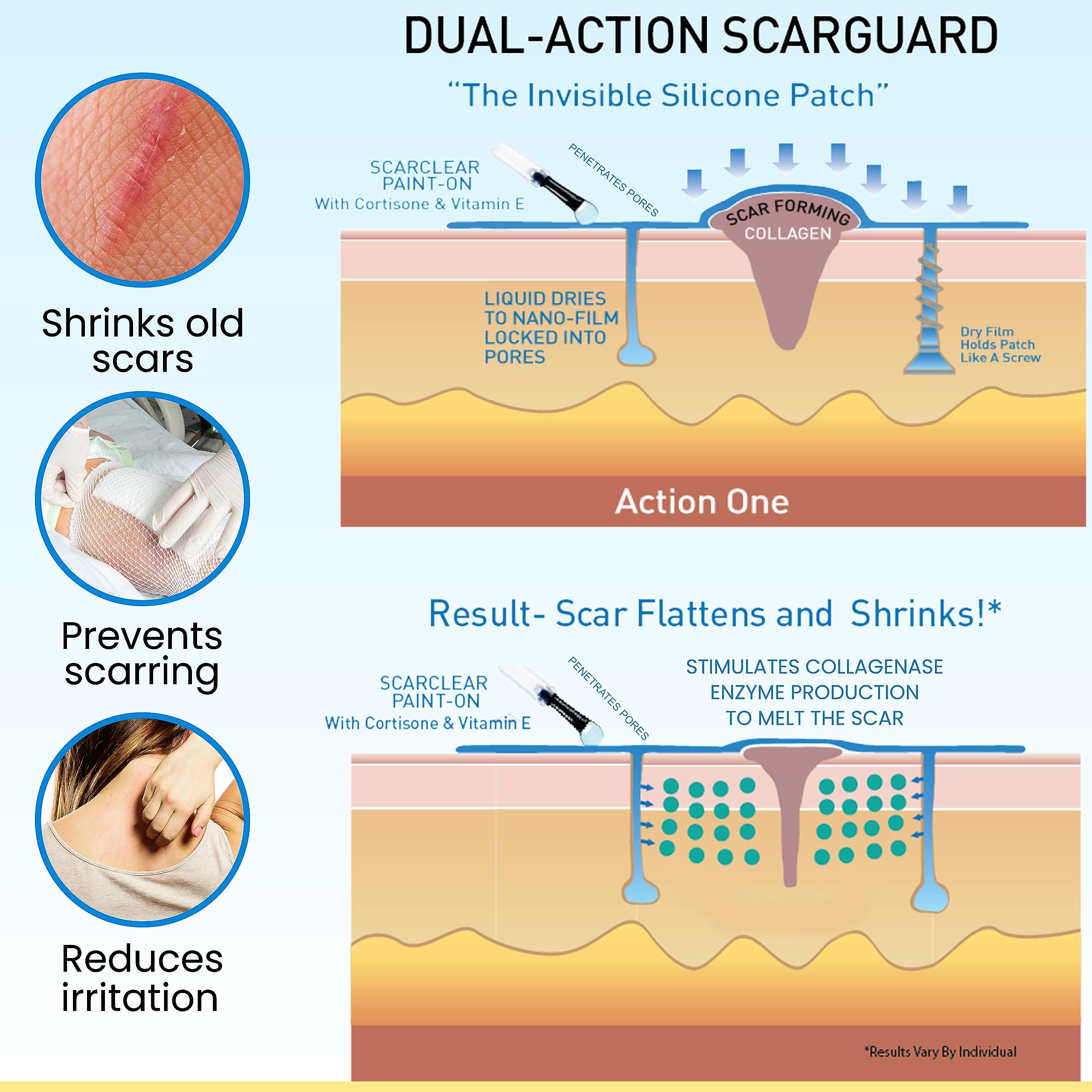 ScarGuard - Invisible Brush-On Silicone Liquid with Vitamin E for Scars (Keloids, Surgical, Burns)