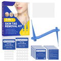 SHISUIZHE Skin Tag Remover – FDA-Cleared At-Home Skin Tag Removal Kit