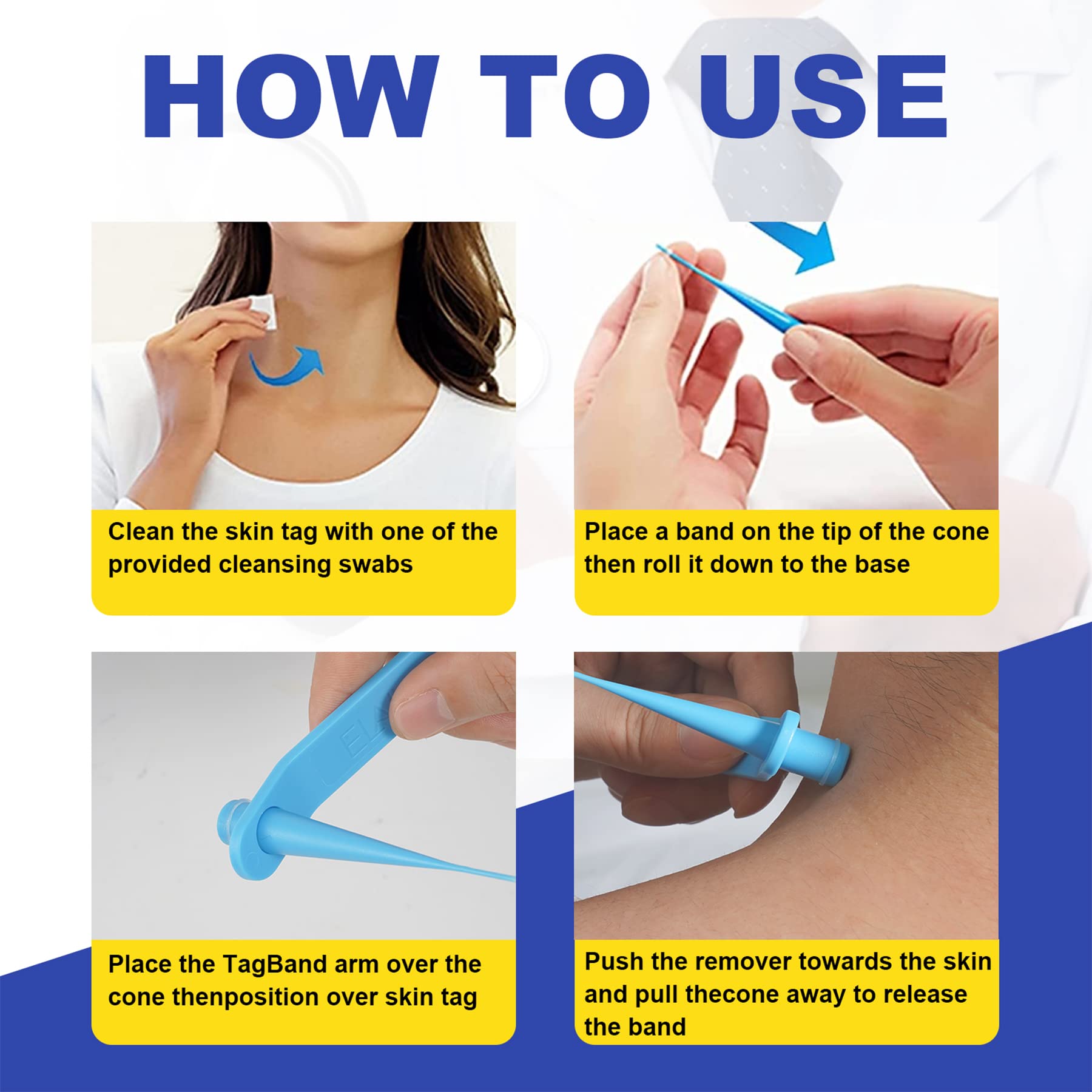 SHISUIZHE Skin Tag Remover – FDA-Cleared At-Home Skin Tag Removal Kit