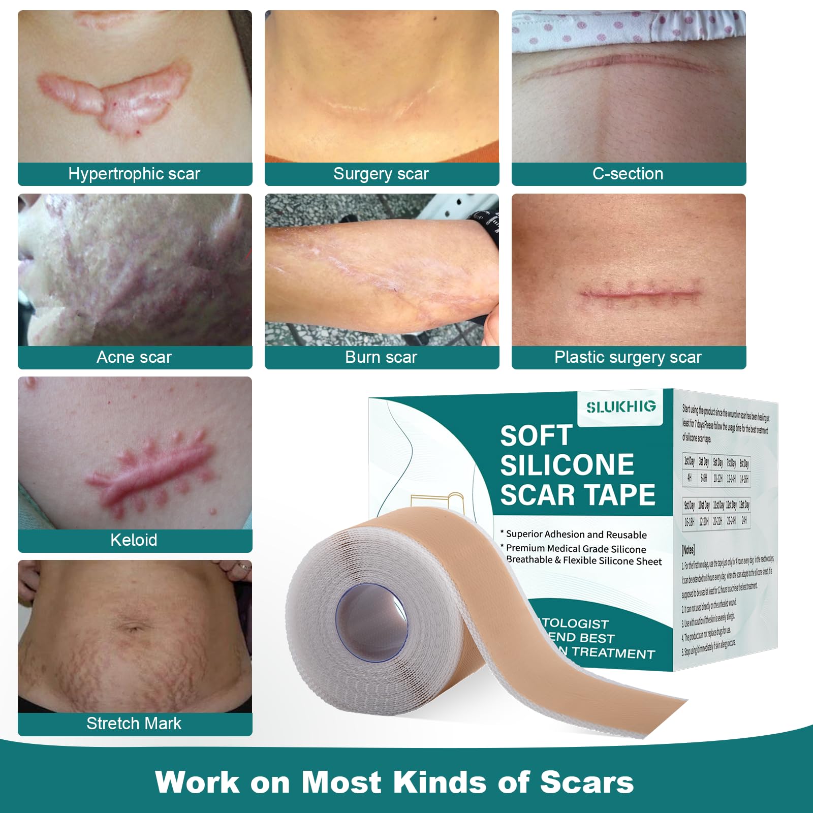 SLUKHIG Silicone Scar Sheets Roll 2M – Reusable Scar Tape for C-Section & Surgical Scars
