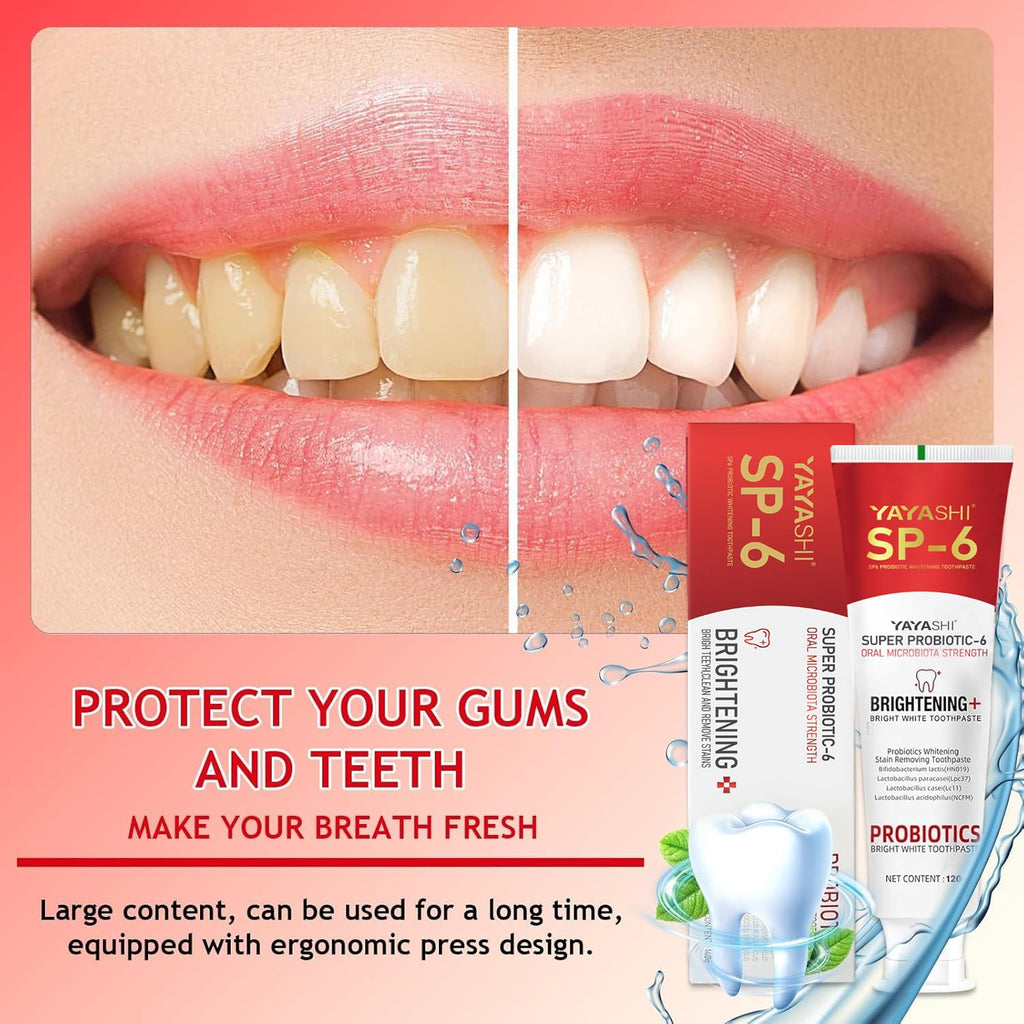 2-Pack SP-6 Probiotic Whitening Toothpaste – Enamel-Safe, Fluoride-Free, Double Mint